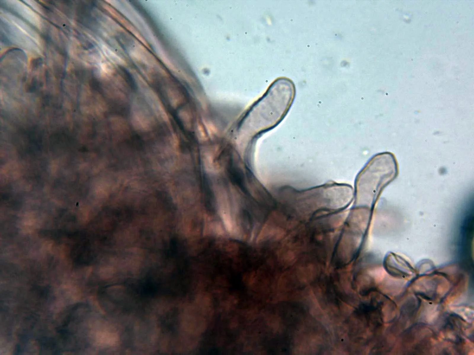 Microscopía de Marasmius oreades - 11 - Caulocistidios 1